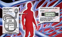 Animas' Glucose Sensor