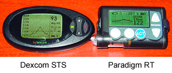 Dexcom STS and Paradigm RT screens compared