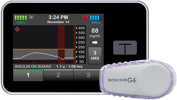 t:slim X2 with Basal IQ by Tandem Diabetes