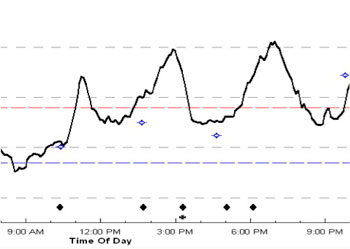 Examples of post-meal “spikes”