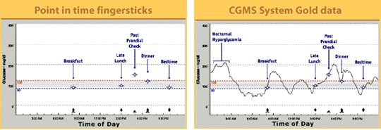 Compare Fingersticks and the CGMS