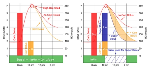 Super Bolus