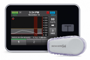 Tandem Pump and Dexcom Sensor