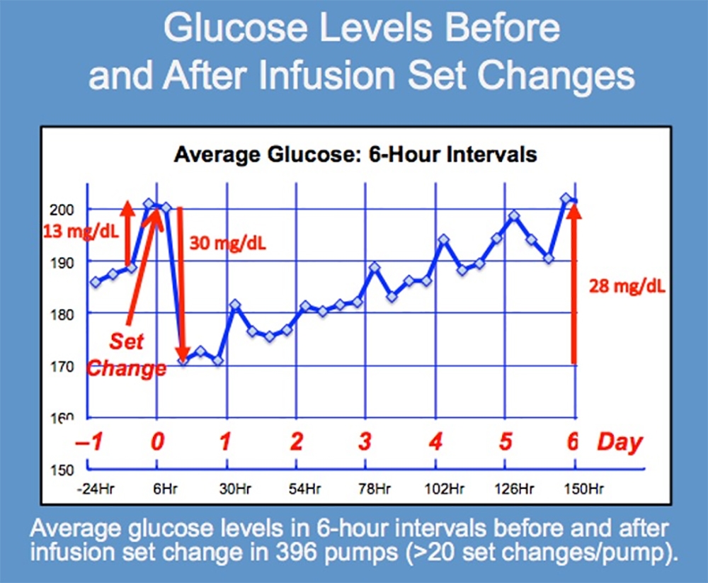 A Graph of Glucose Levels Before and After Infusion Set Changes