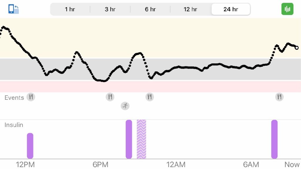 Dexcom 24 Hour Graph