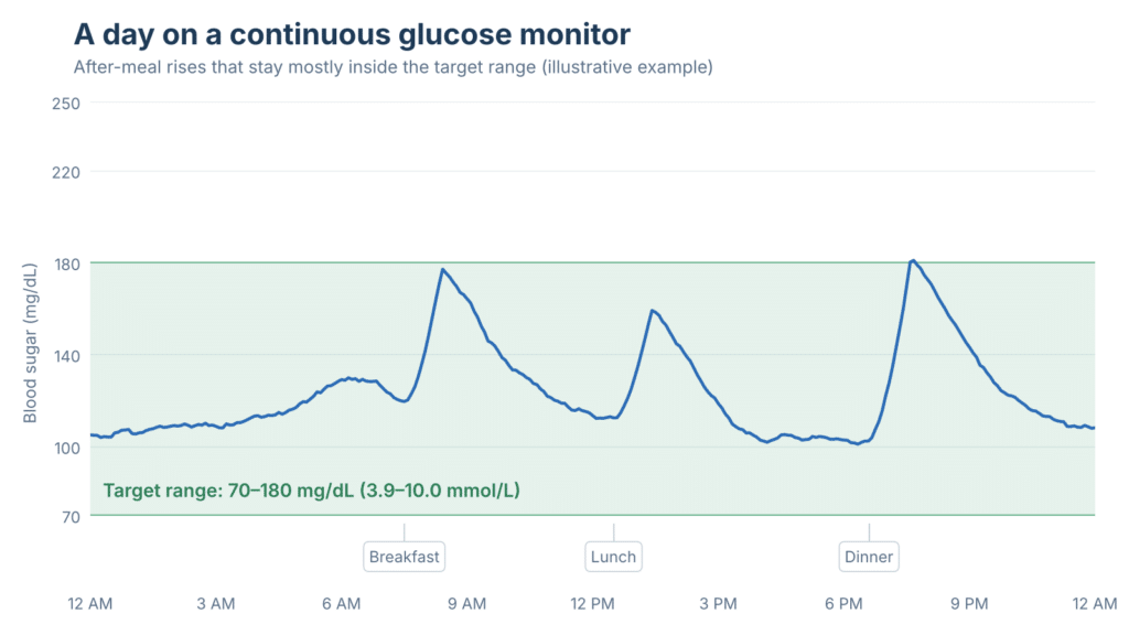 CGM chart showing blood sugar time in range of 70 to 180 mg/dL